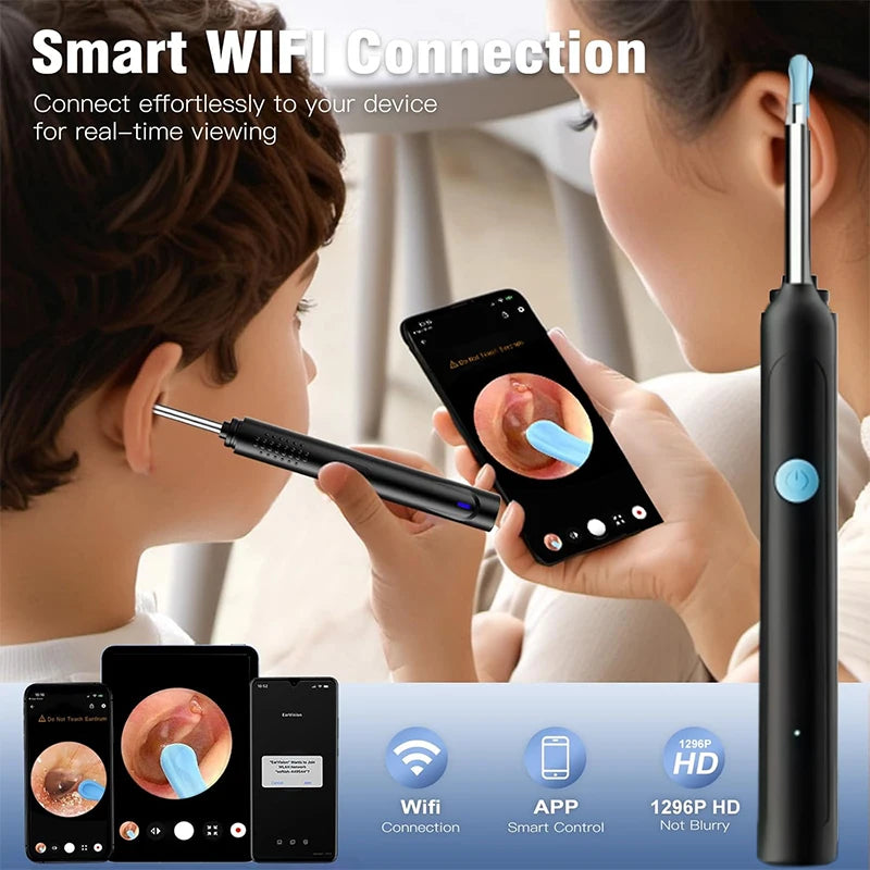 Nettoyeur d'oreilles visuel HD intelligent - Otoscope sans fil 1080P avec kit de suppression de cérumen en silicone