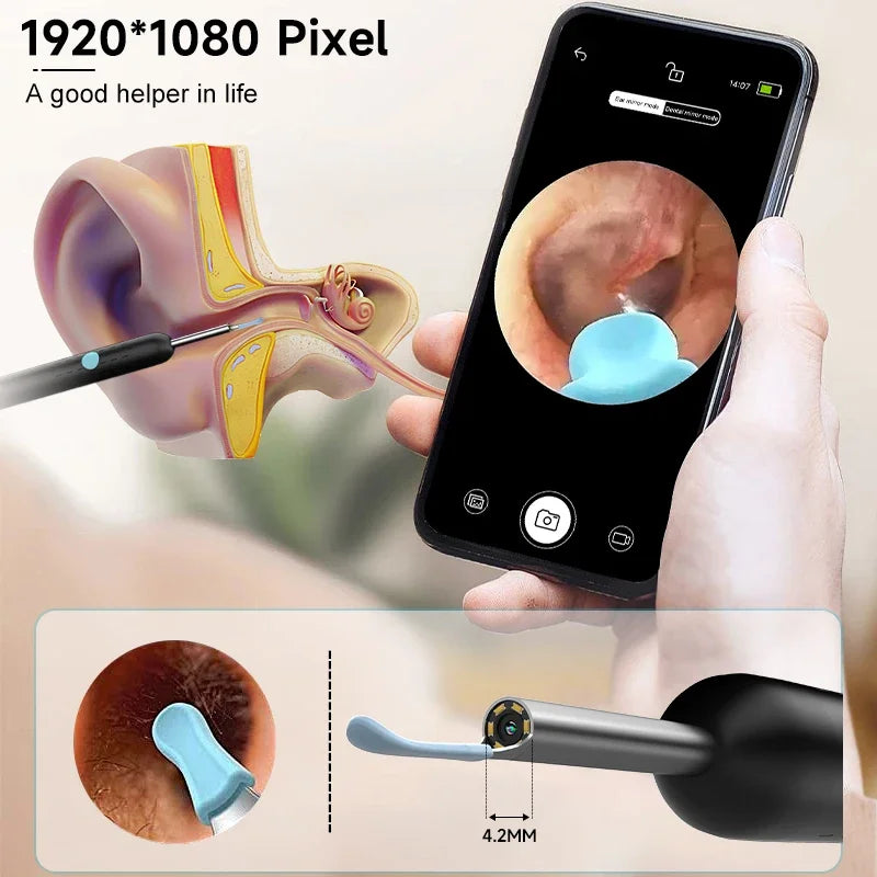 Nettoyeur d'oreilles visuel HD intelligent - Otoscope sans fil 1080P avec kit de suppression de cérumen en silicone