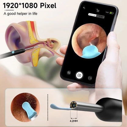 Smart HD Visual Ear Cleaner - 1080P Wireless Otoscope with Silicone Ear Wax Removal Kit