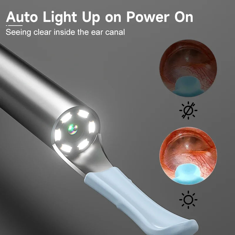 Nettoyeur d'oreilles visuel HD intelligent - Otoscope sans fil 1080P avec kit de suppression de cérumen en silicone