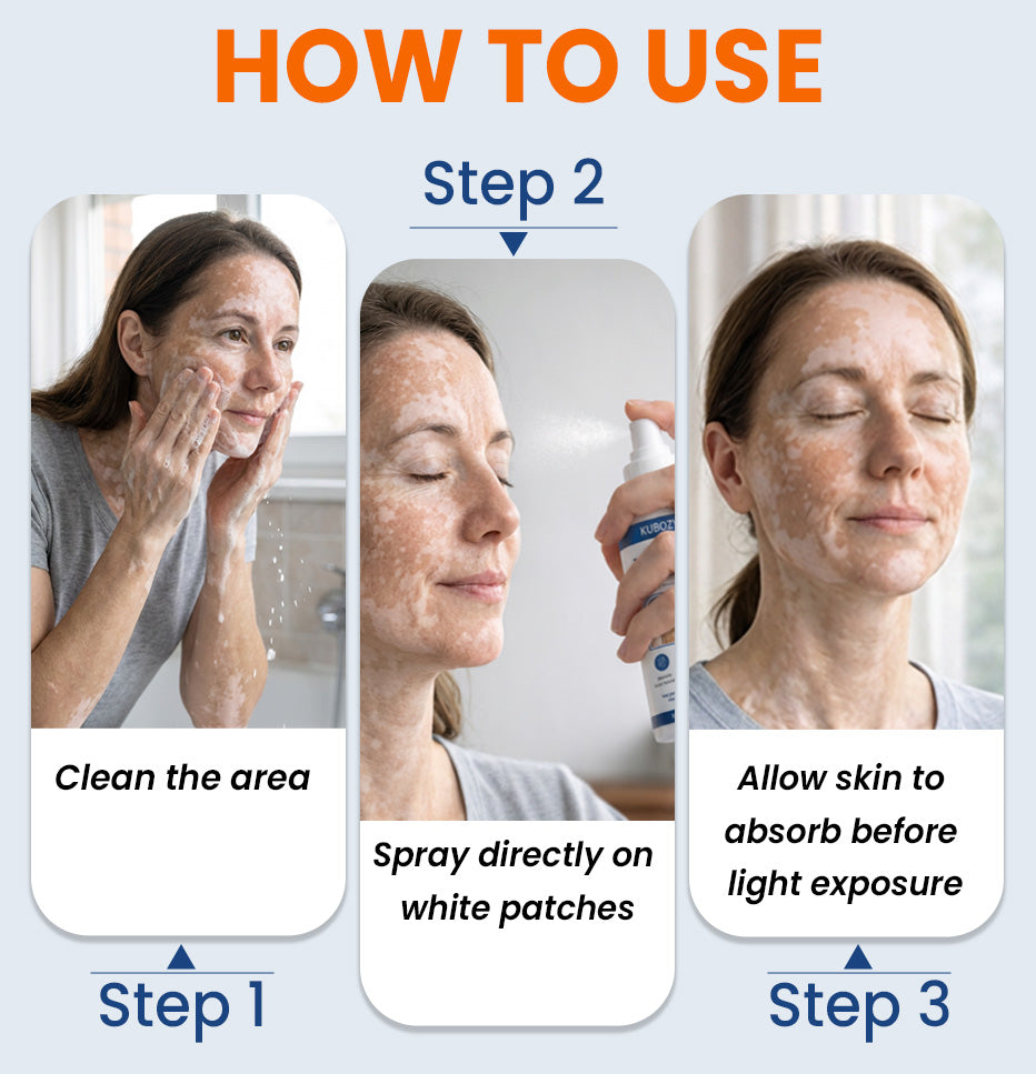 ⚡KUBOZN® Spray activateur de repigmentation à la pipérine pour réactiver les cellules pigmentaires dormantes et restaurer la couleur naturelle de la peau